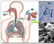 Барилга барих, нураах үед асбест агаарт тархаж, хавдар үүсгэх шалтгаан болж байна
