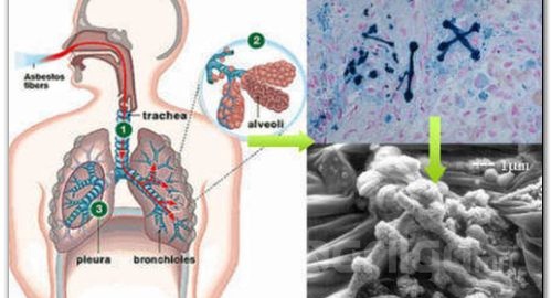 Барилга барих, нураах үед асбест агаарт тархаж, хавдар үүсгэх шалтгаан болж байна